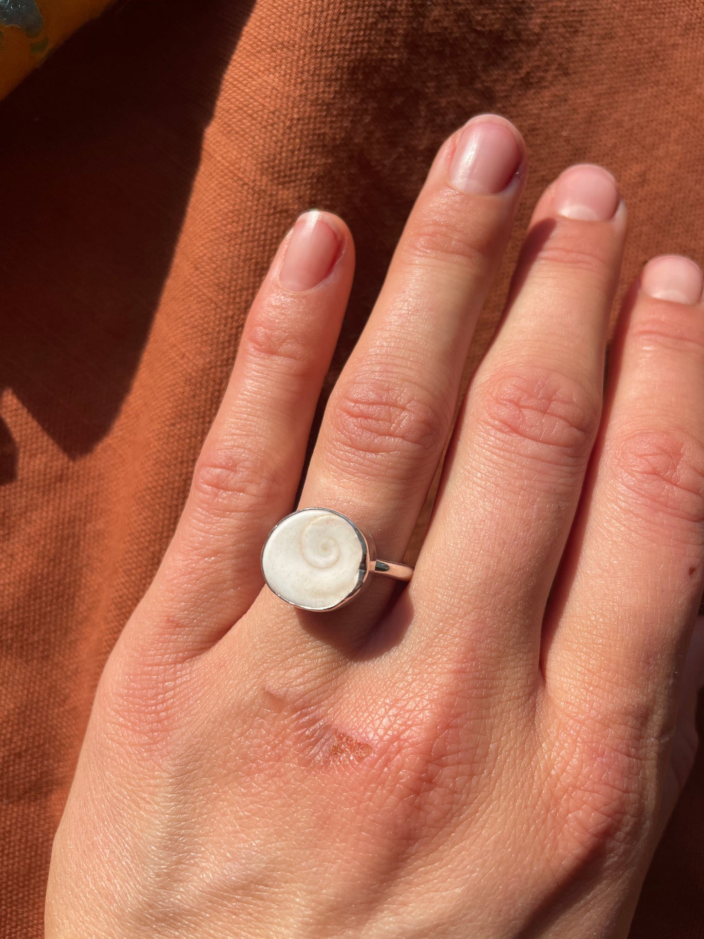 Operculum Ring